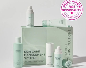 Professional chemical peel treatment at Select Health