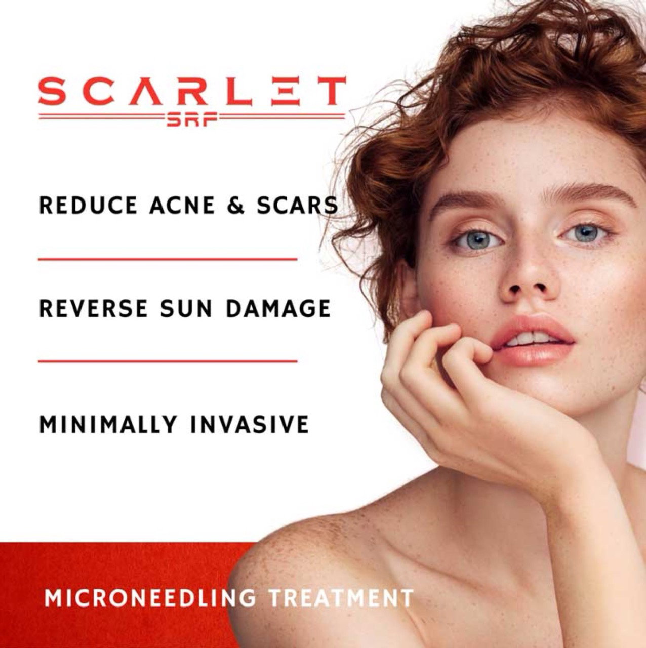 Dermaplane treatment at Select Health